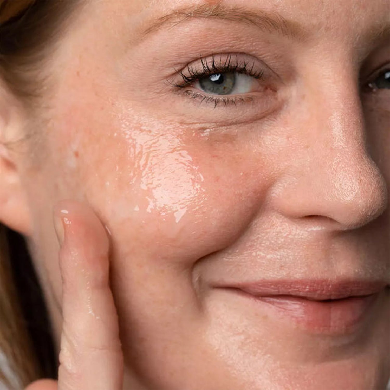 Acné & imperfections
